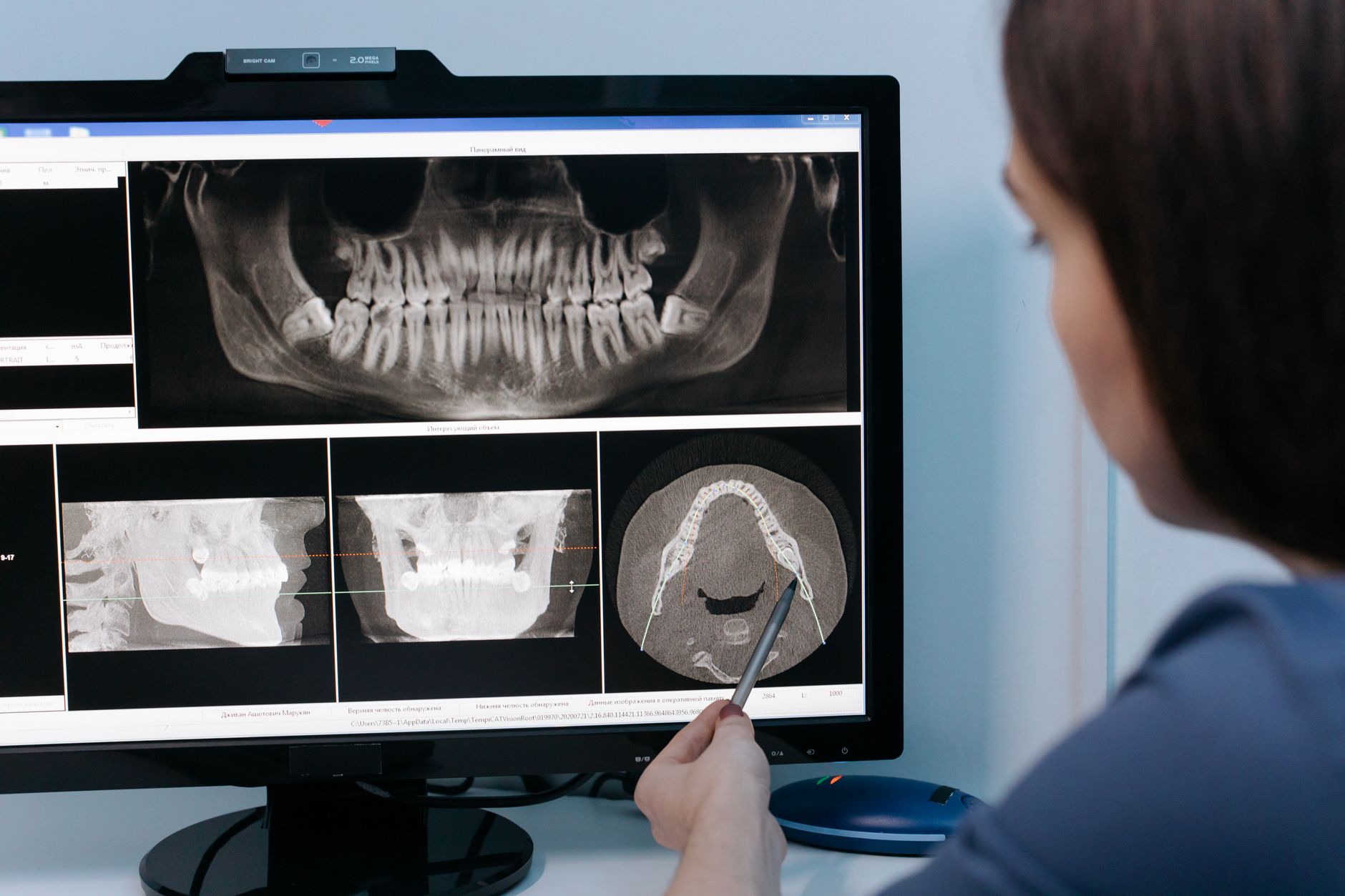 A dentist pointing at a 3D dental scan on a computer screen