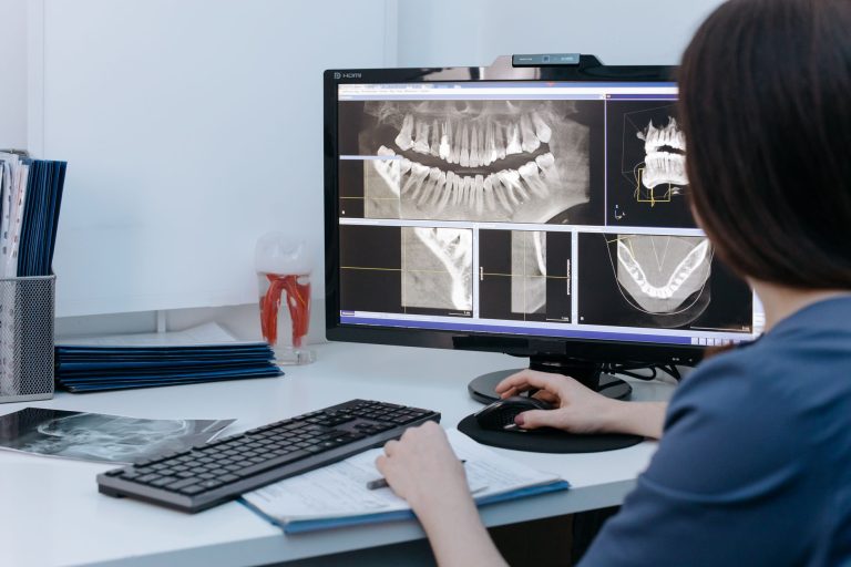 A clinician at a desk reviewing cone beam CT views of a jaw on a computer monitor